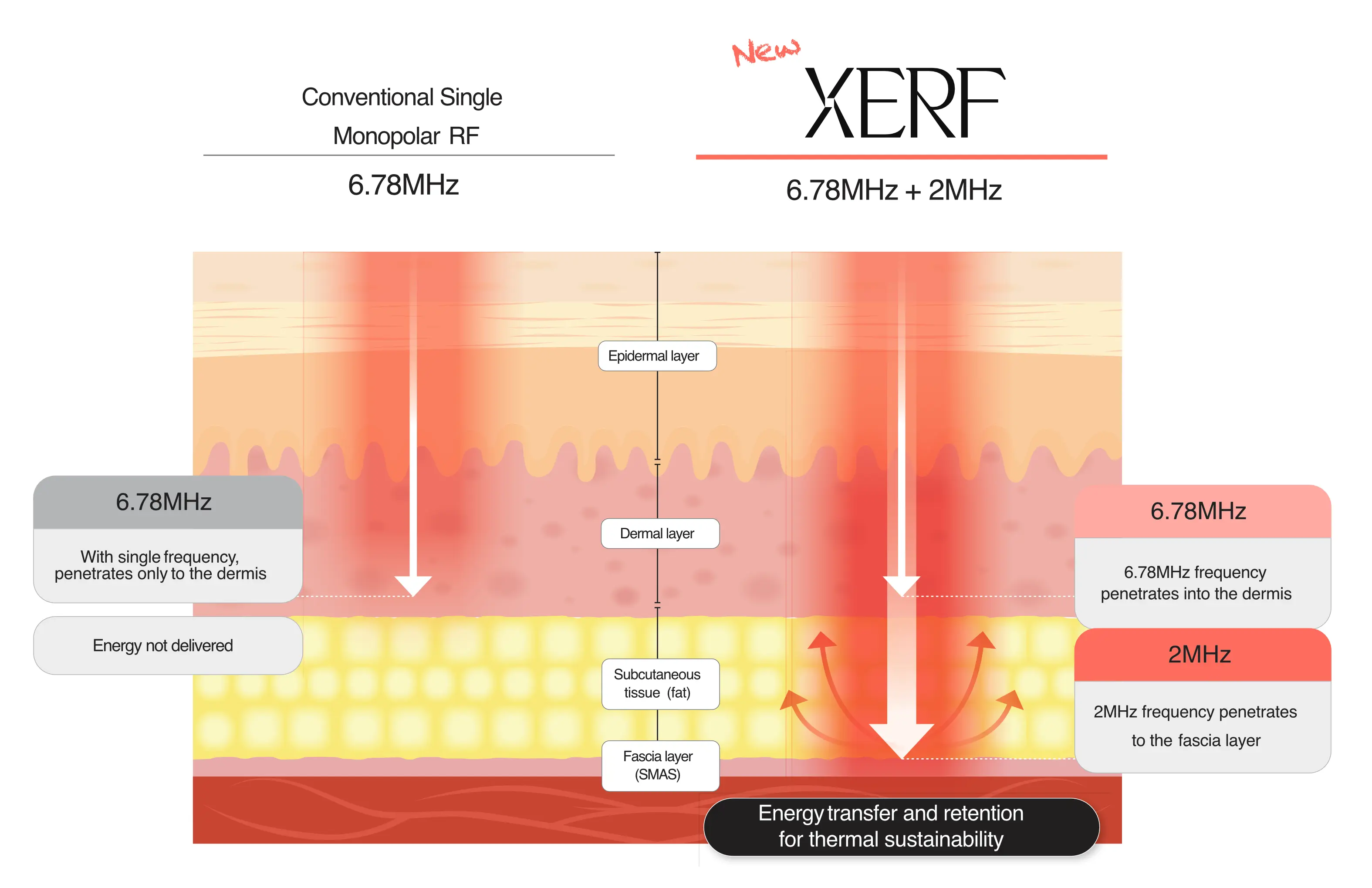 Diagram comparing conventional single-frequency RF penetration with XERF dual-frequency RF delivery across skin layers